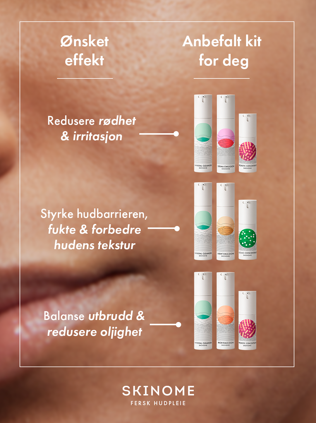 Skinome Facebook ad