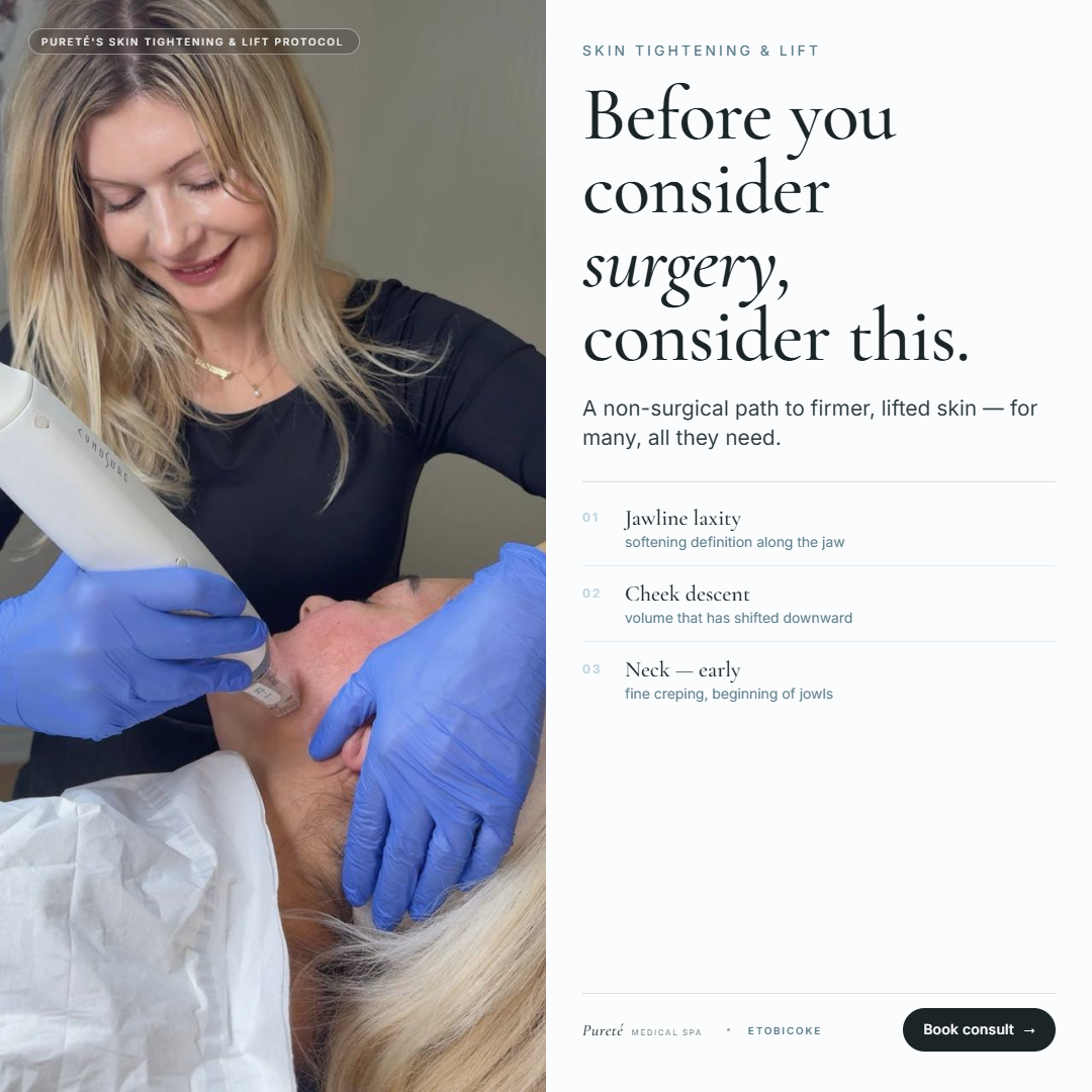 Pureté Medical Spa Facebook ad from May 10, 2026