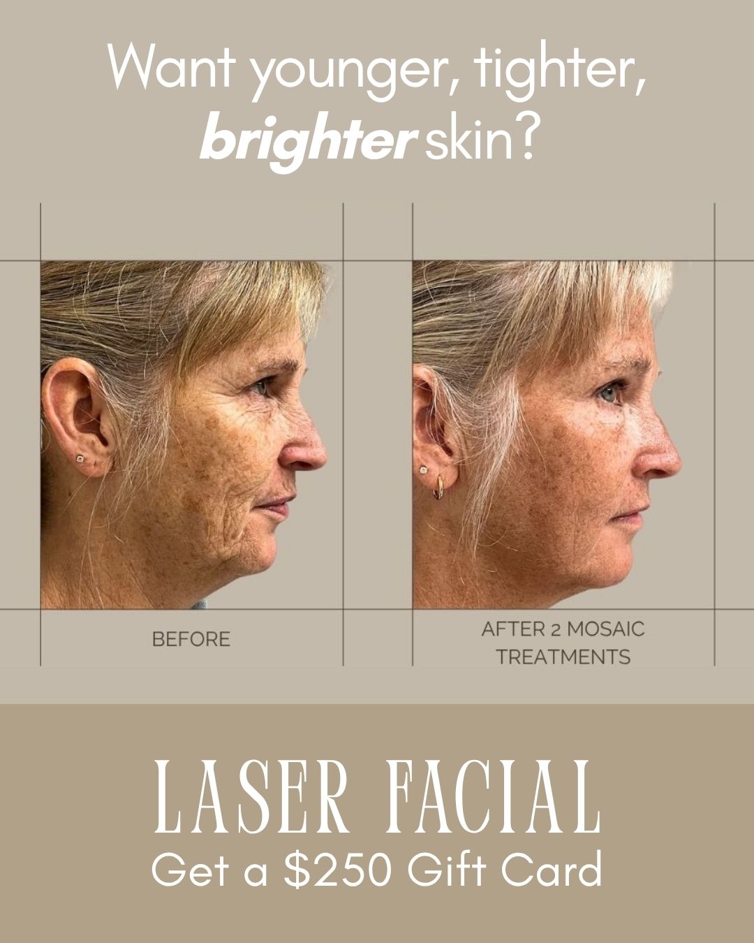Fountain of Youth Skin Renewal Centre Facebook ad