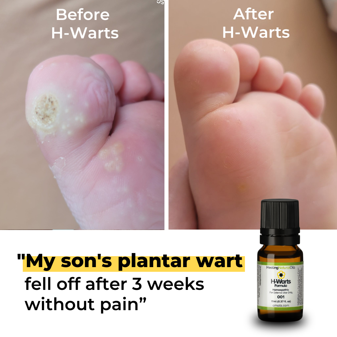 Healing Natural Oils Facebook ad