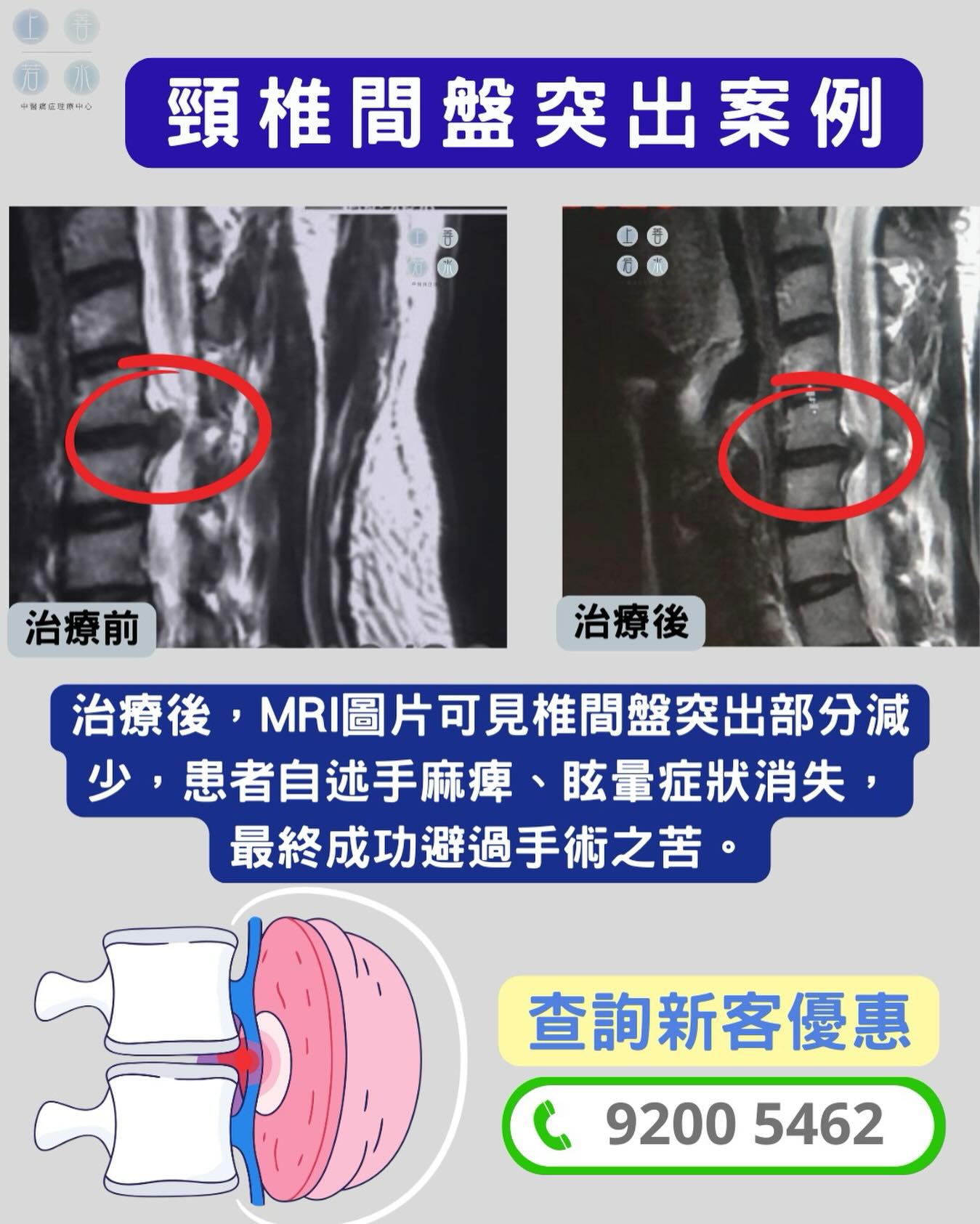 上善若水中醫痛症理療中心 Mercy Chinese Medicine Clinic 筋膜痛症 Chronic Pain Treatment Facebook ad
