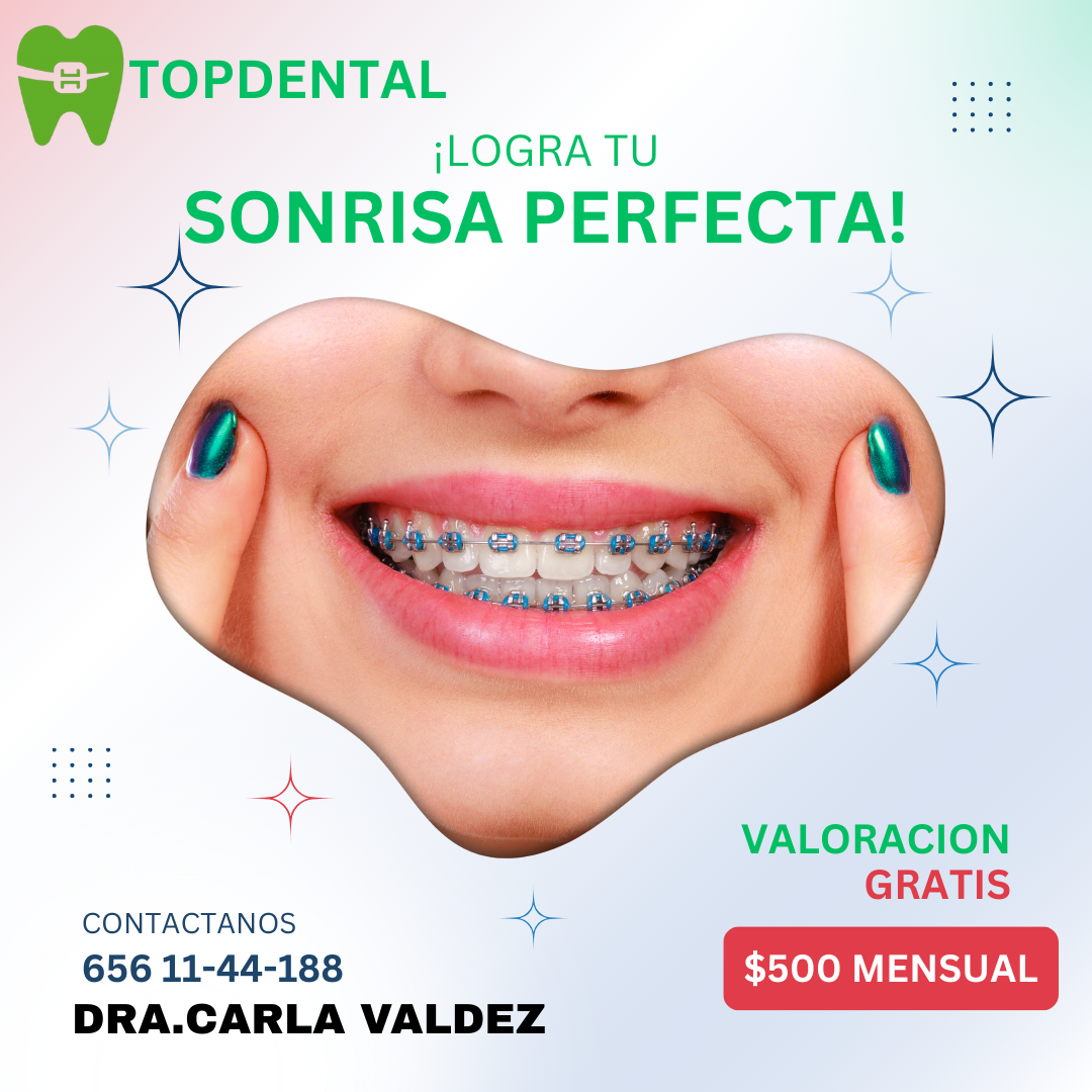 Top Dental Porvenir Facebook ad: BRACKETS DENTALES