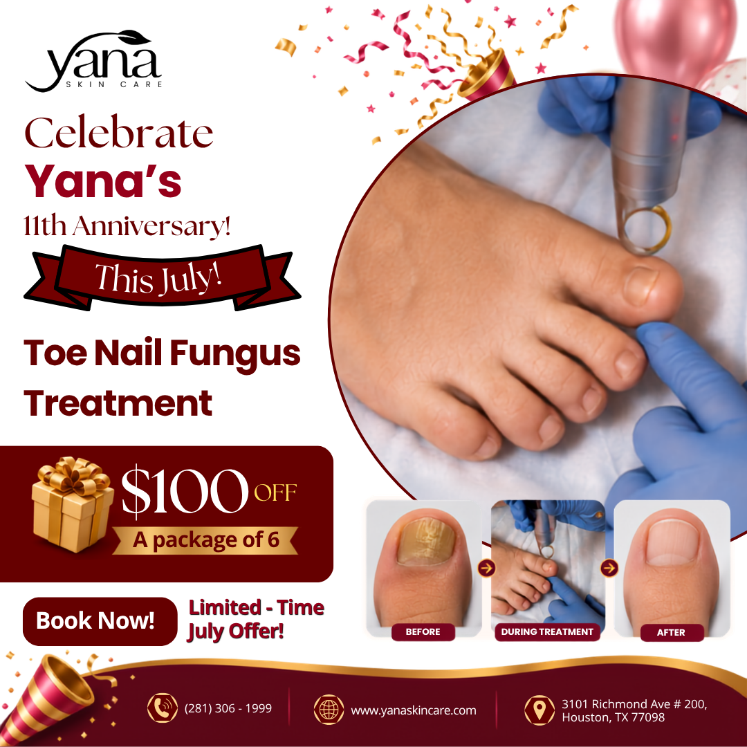 Yana Skin Care Facebook ad: 11th Anniversary Toe Nail Special!