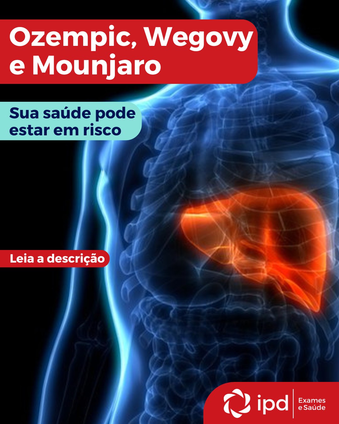 IPD Saúde Facebook ad: Medicamentos para emagrecimento: por que o acompanhamento…