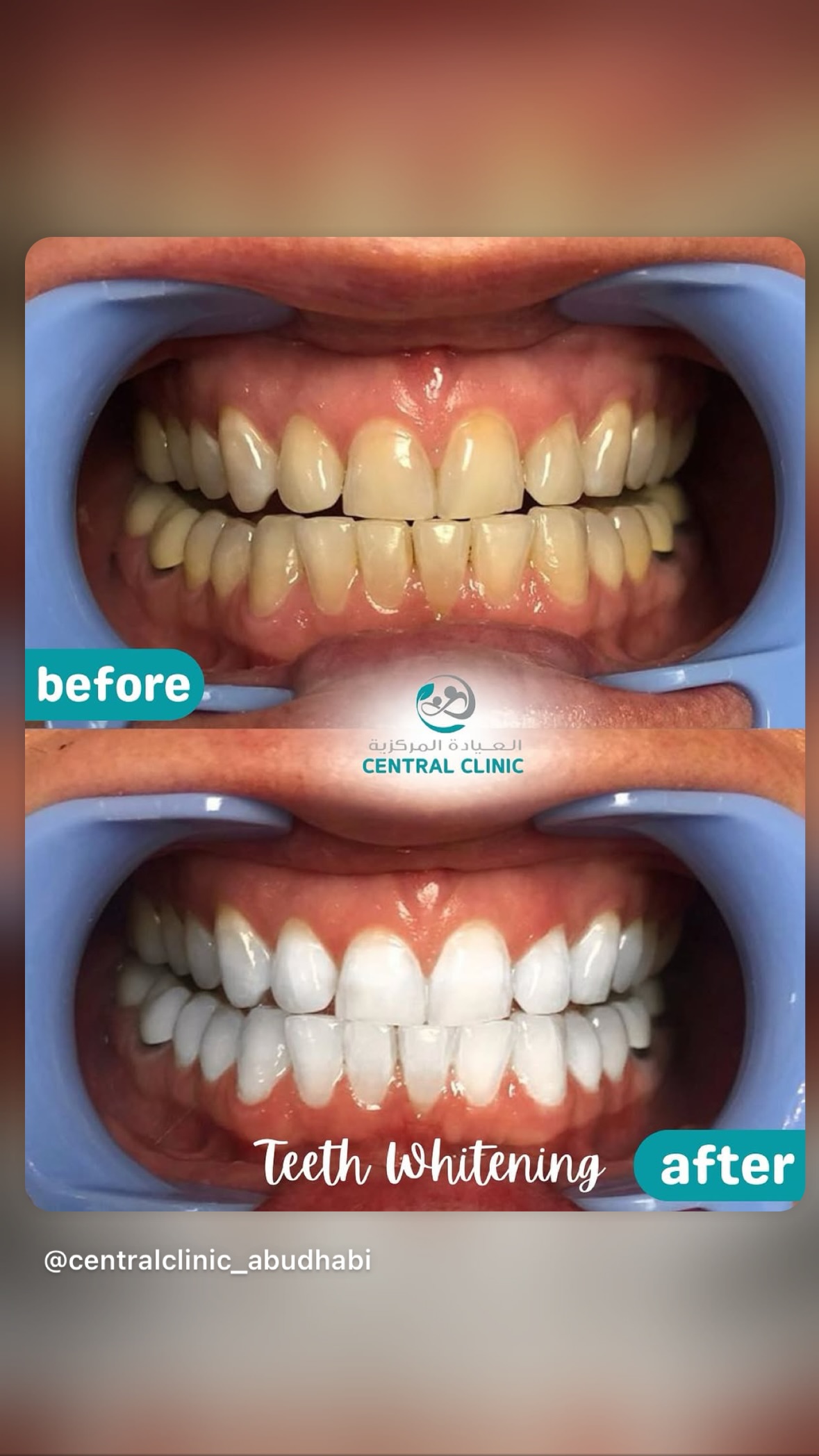 Central Clinic Facebook ad: Chat with us