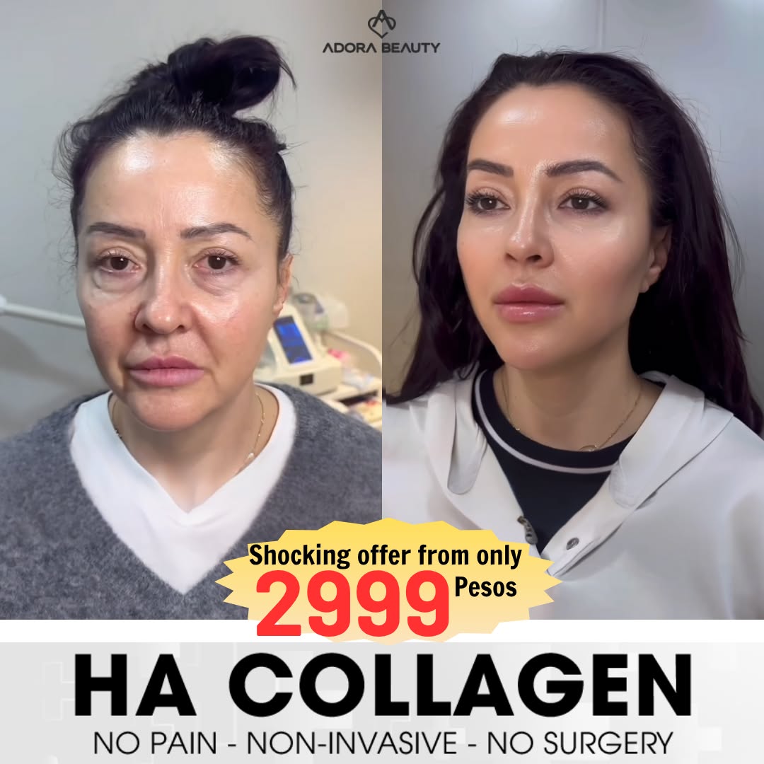 ADORA Beauty Center - Where beauty reigns Facebook ad