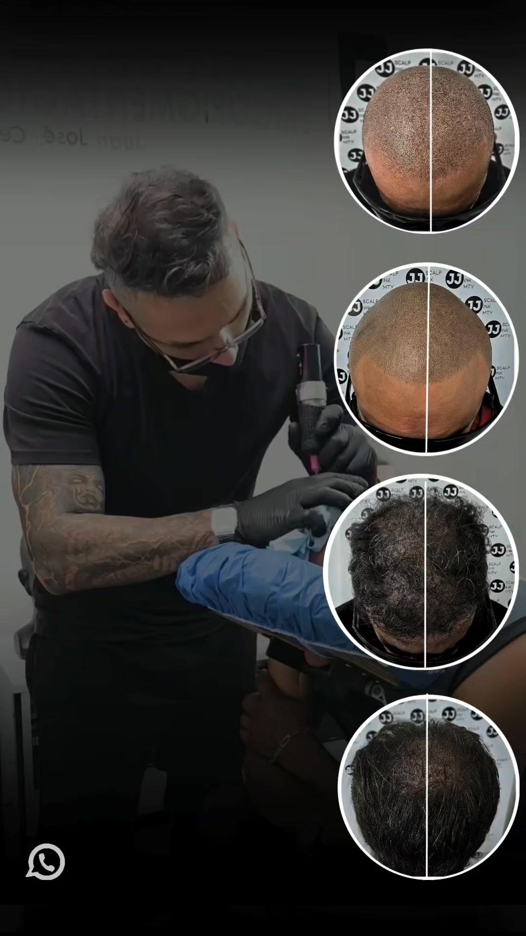 JJ SCALP INK MTY Facebook ad: Micropigmentación Capilar en Hombres