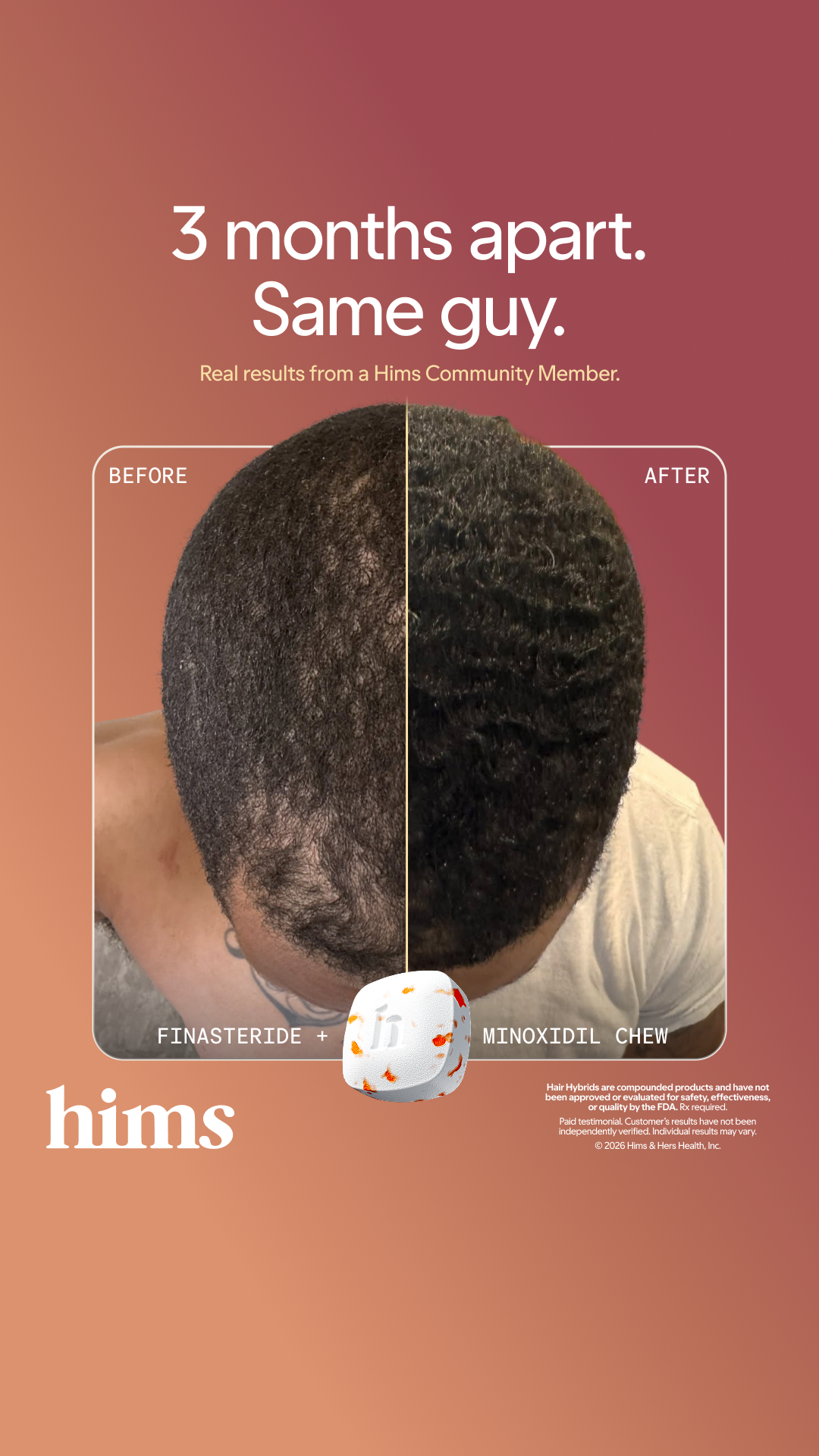 hims Facebook ad: Get started today