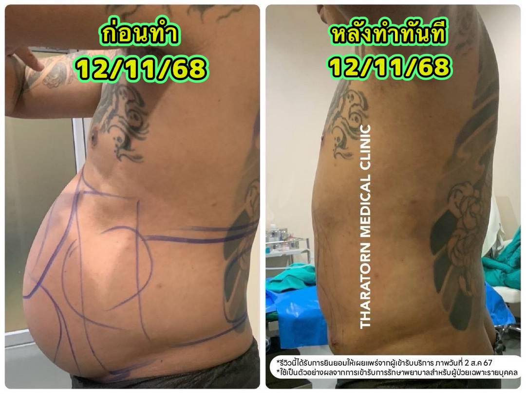 Tharatorn Medical Clinic Facebook ad