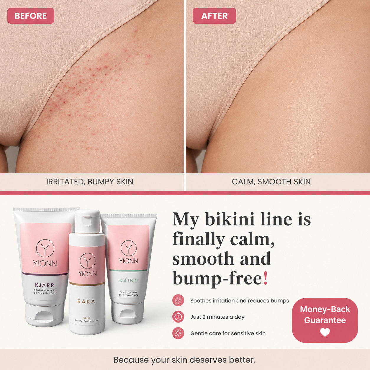 YIONN Facebook ad: What if it isn't your sensitive skin?