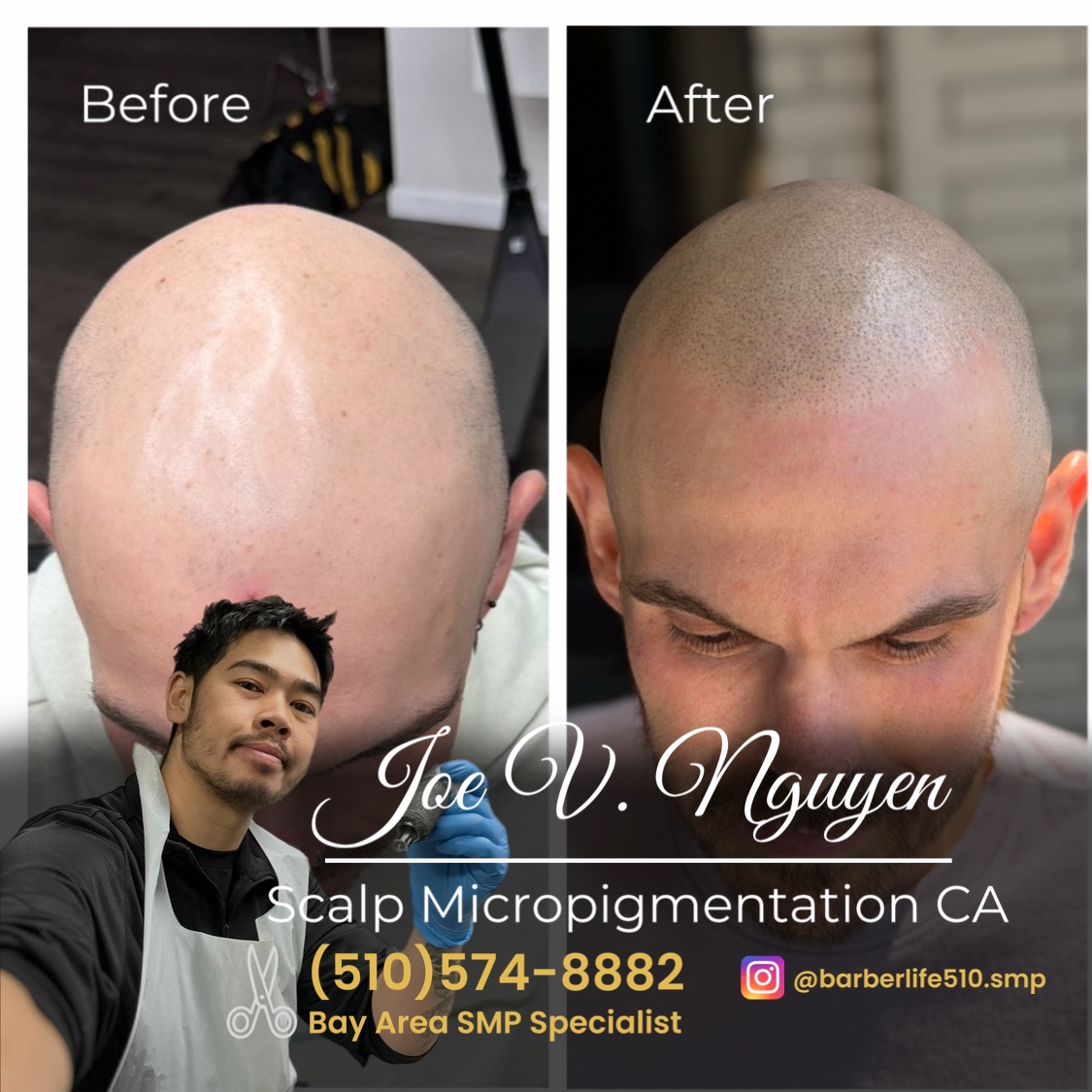 Scalp Micropigmentation CA - SMPCA Academy Facebook ad