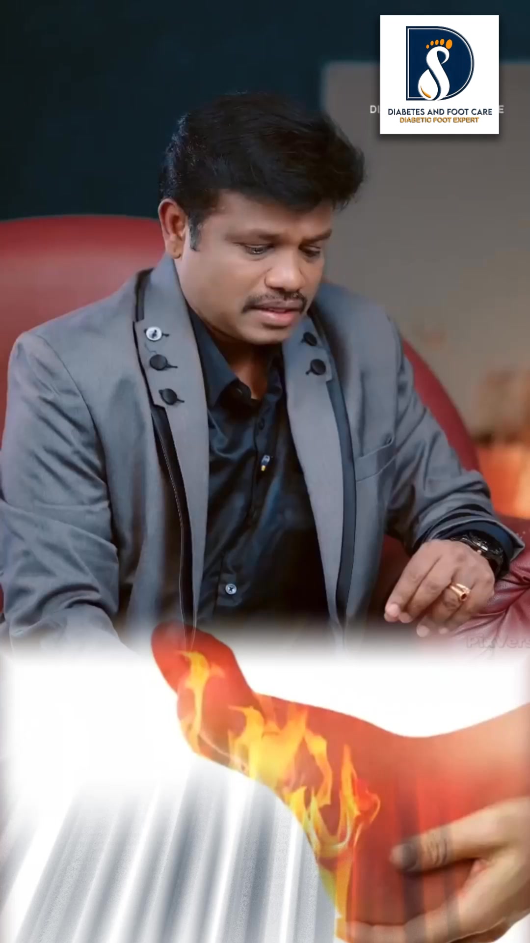 Dr.Durai Nagarethinam Facebook ad: பாத எரிச்சல் பிரச்சனை உங்களுக்கா?