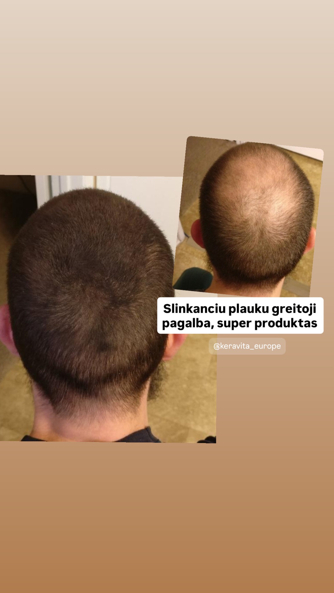 Keravita Facebook ad: Plaukų tankinimo pluoštai