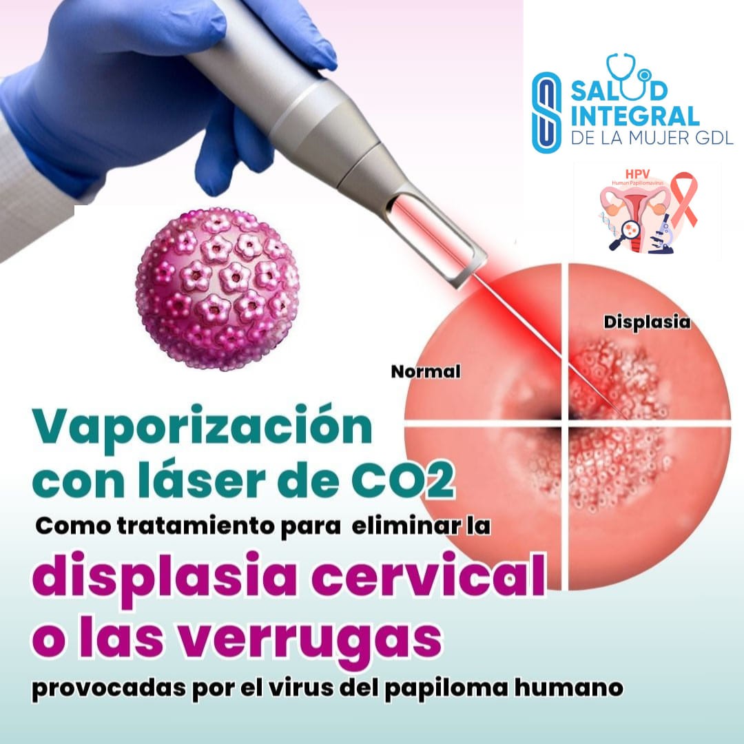 Salud integral de la Mujer GDL-suc Javier mina Facebook ad: tratamiento VPH Laser co2