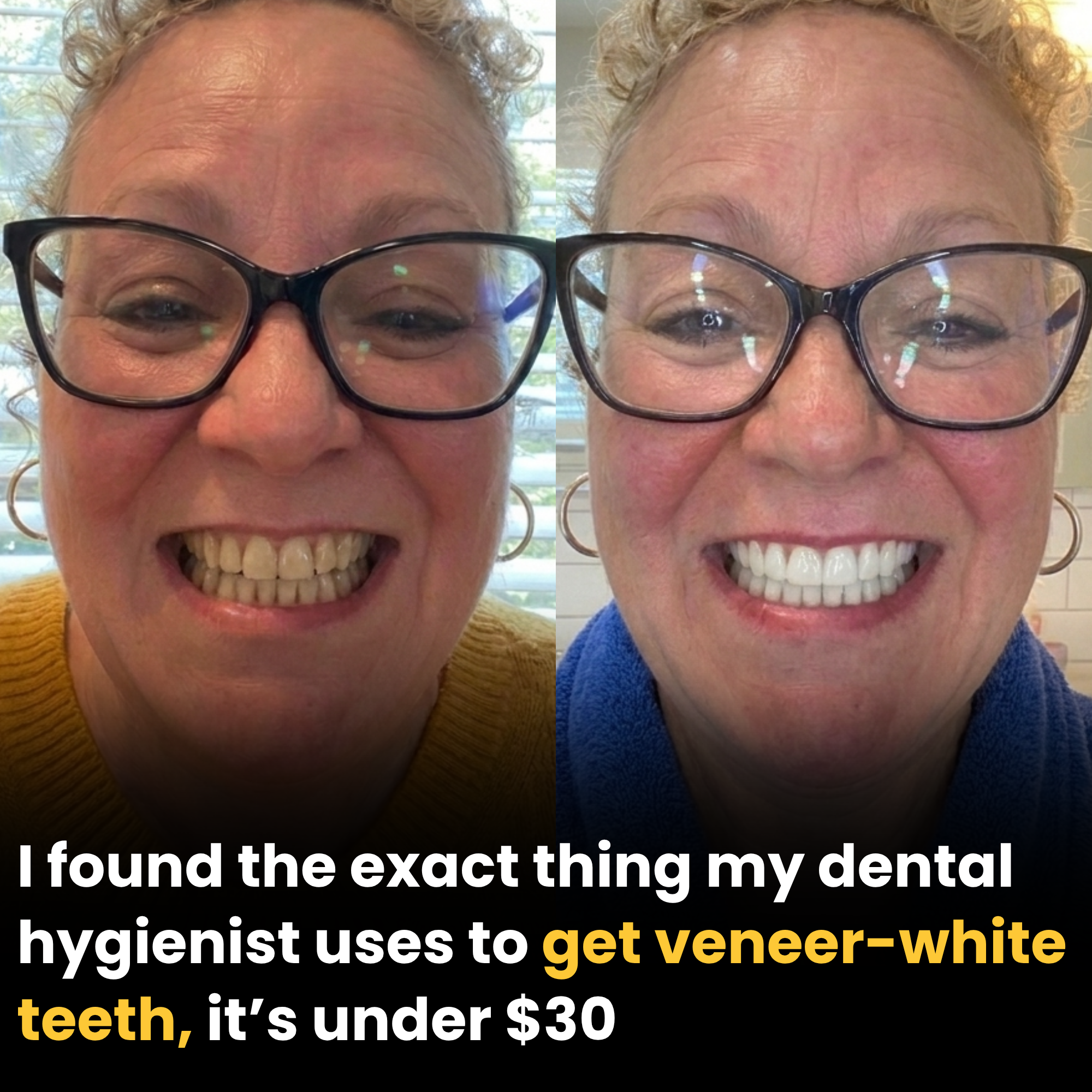 Healthy Living Daily Facebook ad: The $30 Dental Hygienist Secret