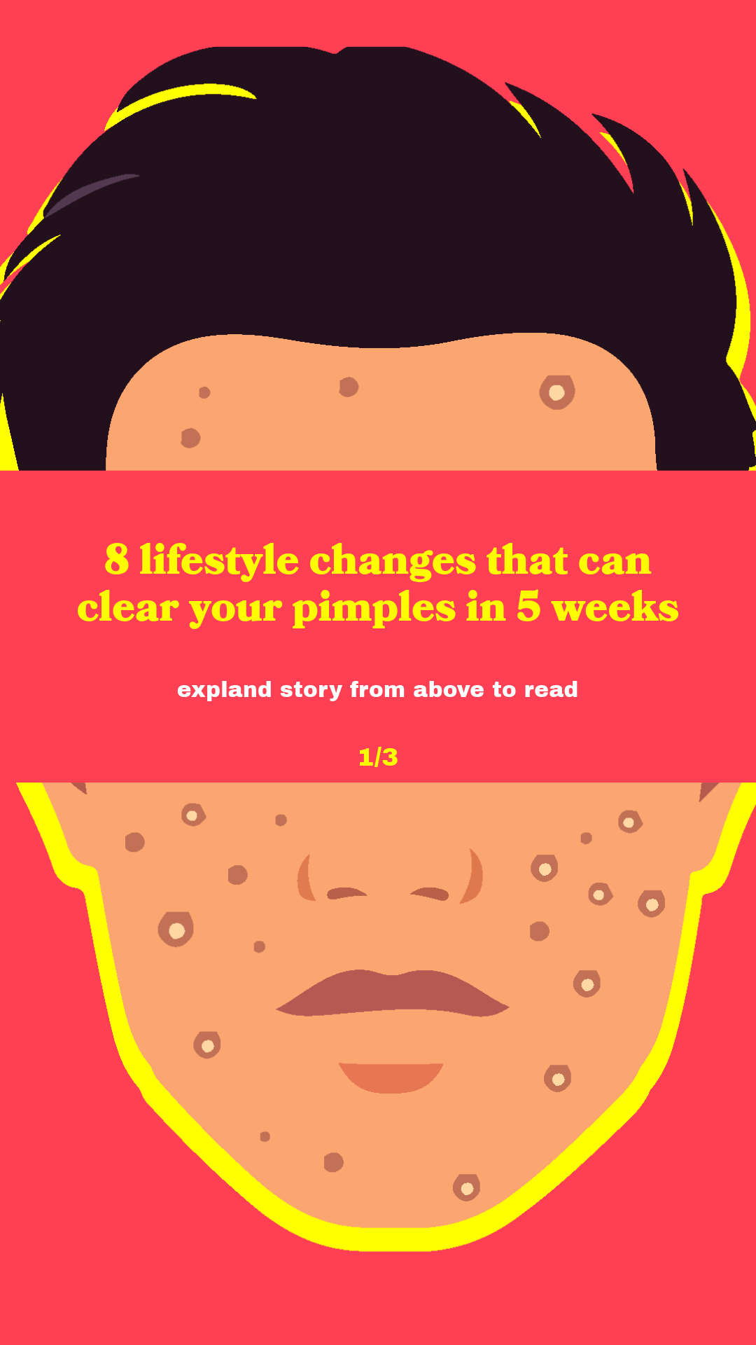 Unhyped acne Facebook ad