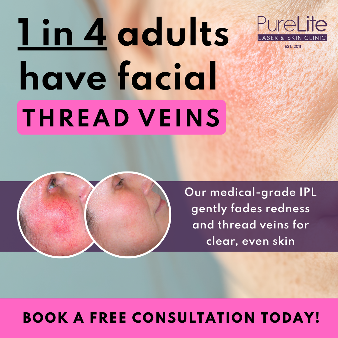 PureLite Laser & Skin Clinic Facebook ad from Nov 8, 2025