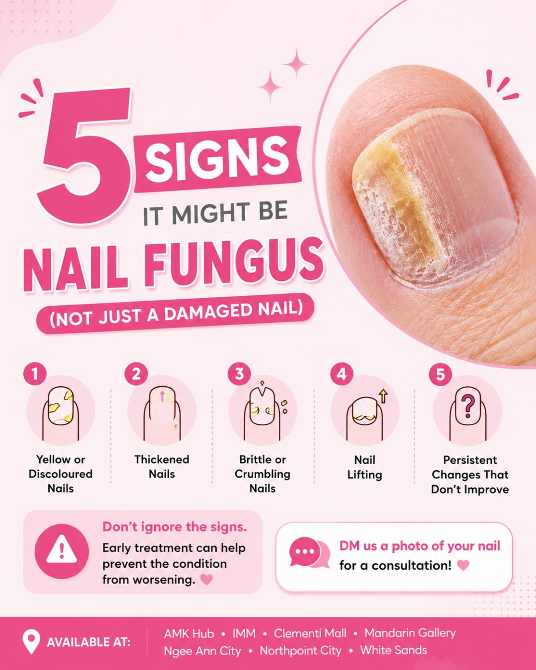 Nailz Haus Facebook ad: Think it's just a damaged nail?