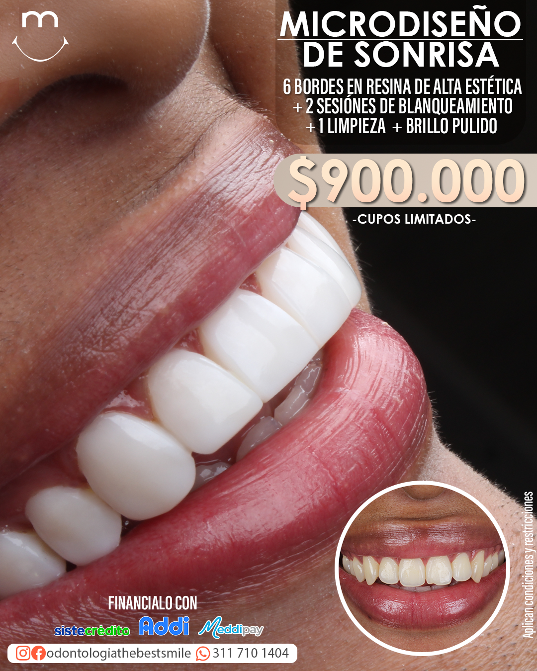 Odontologiathebestsmile. Facebook ad: SOLO CÚCUTA