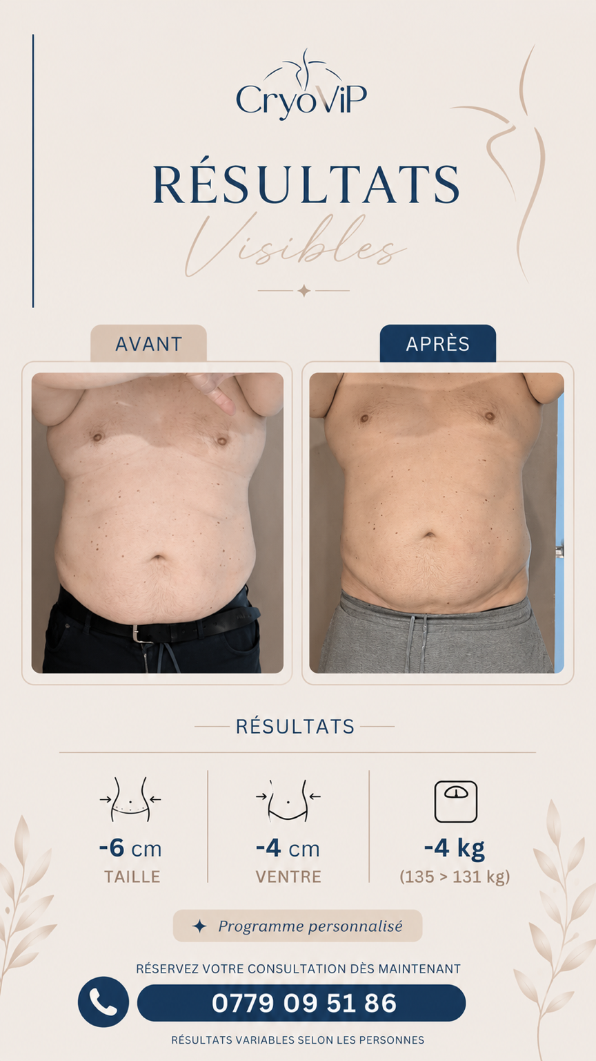 CryoVip Facebook ad: هل جربت كل شيء وما زال الوزن يرفض النزول؟