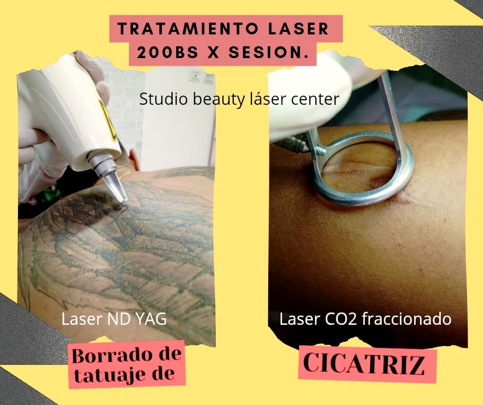 Studio Beauty laser center Facebook ad: Restaura tu piel con tecnología láser