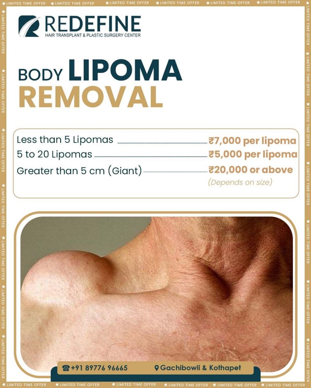 Redefine Skin and Hair Transplant Center Facebook ad
