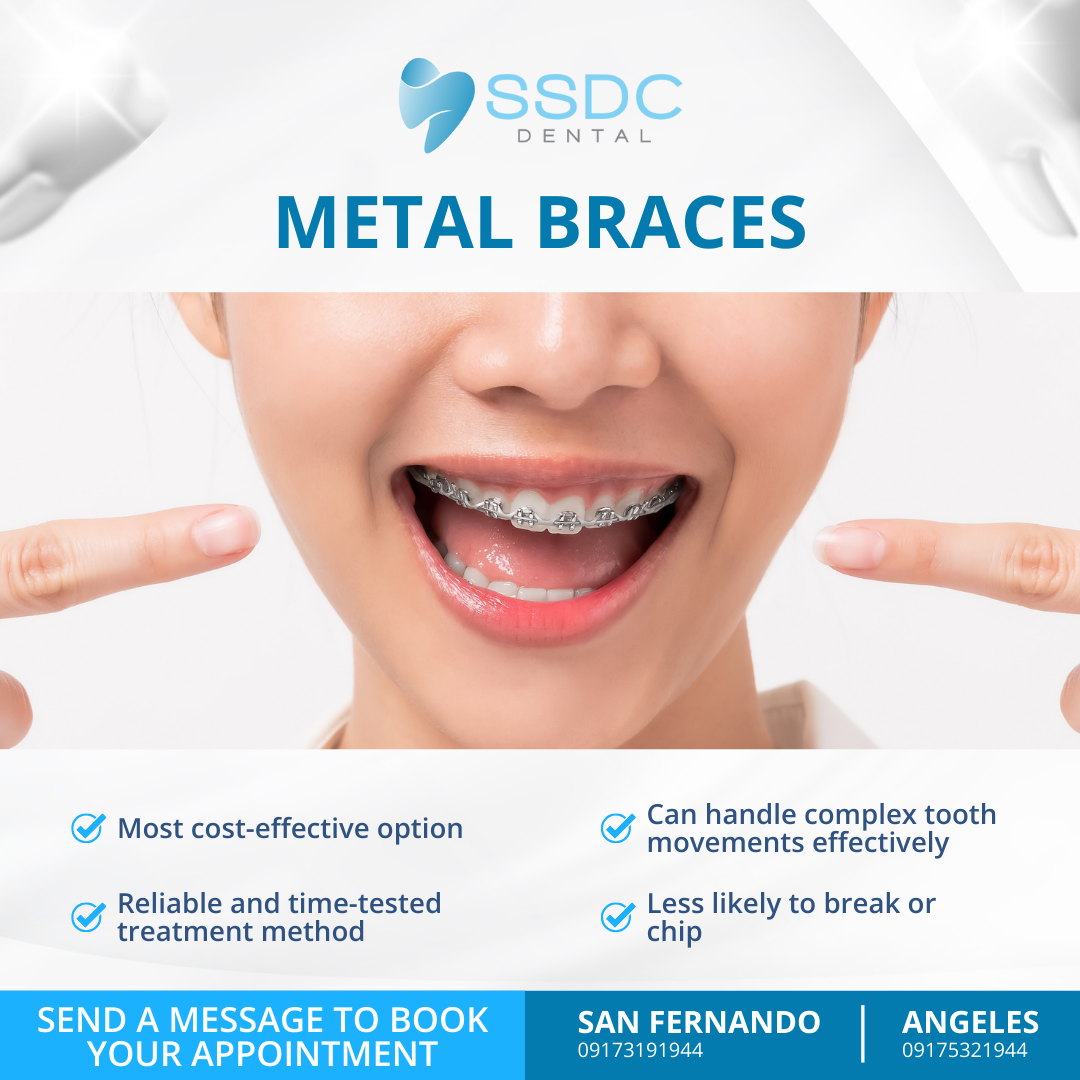 SSDC Dental Facebook ad
