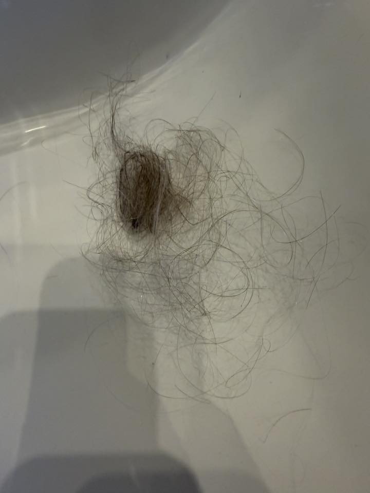 Jennifer Nelson Facebook ad: Reverse GLP-1 Hair Loss