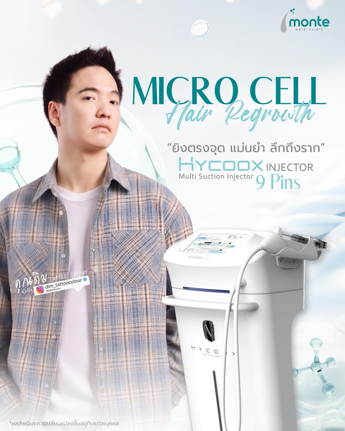 Monte Clinic - Hair Transplant ปลูกผมถาวร คิ้ว หนวดเครา รักษาผมบาง Facebook ad