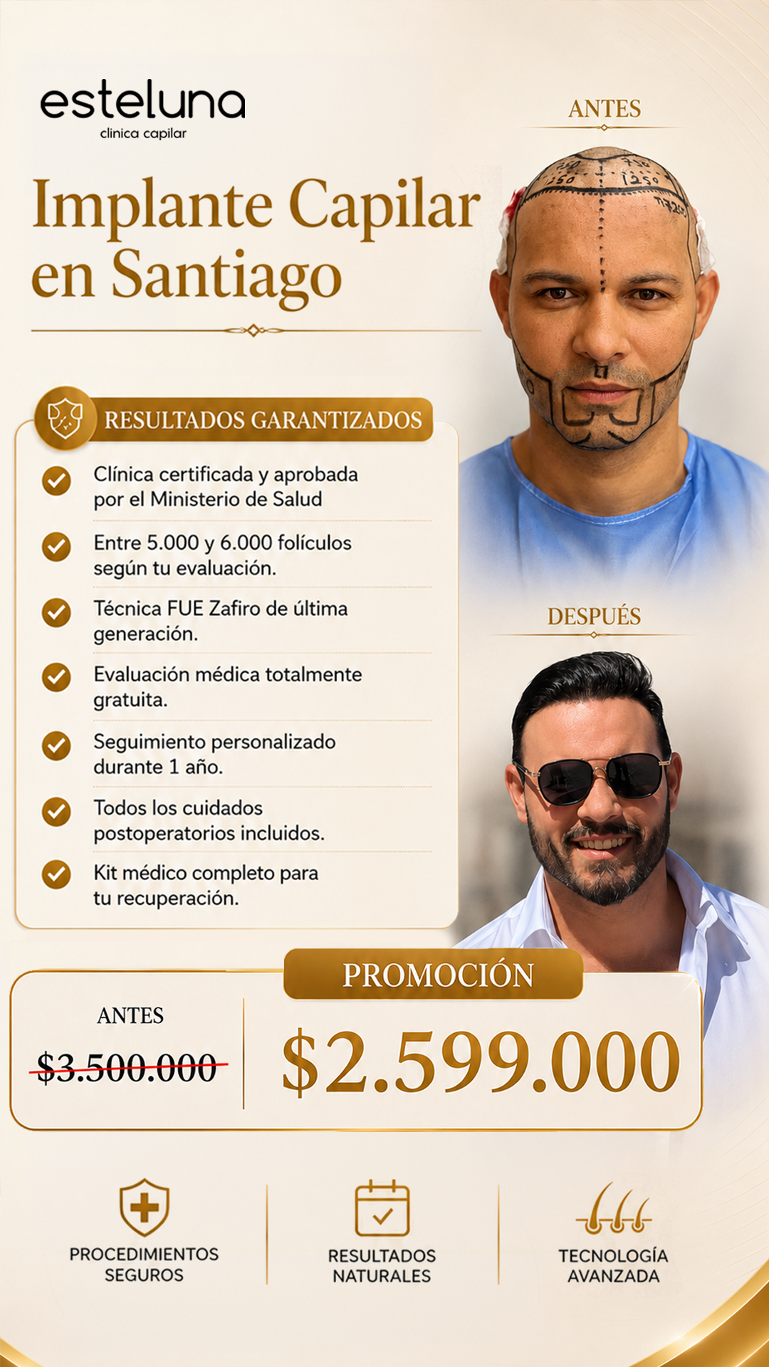 Esteluna Capilar Facebook ad: ¿Sientes que la caída del cabello ha empezado…