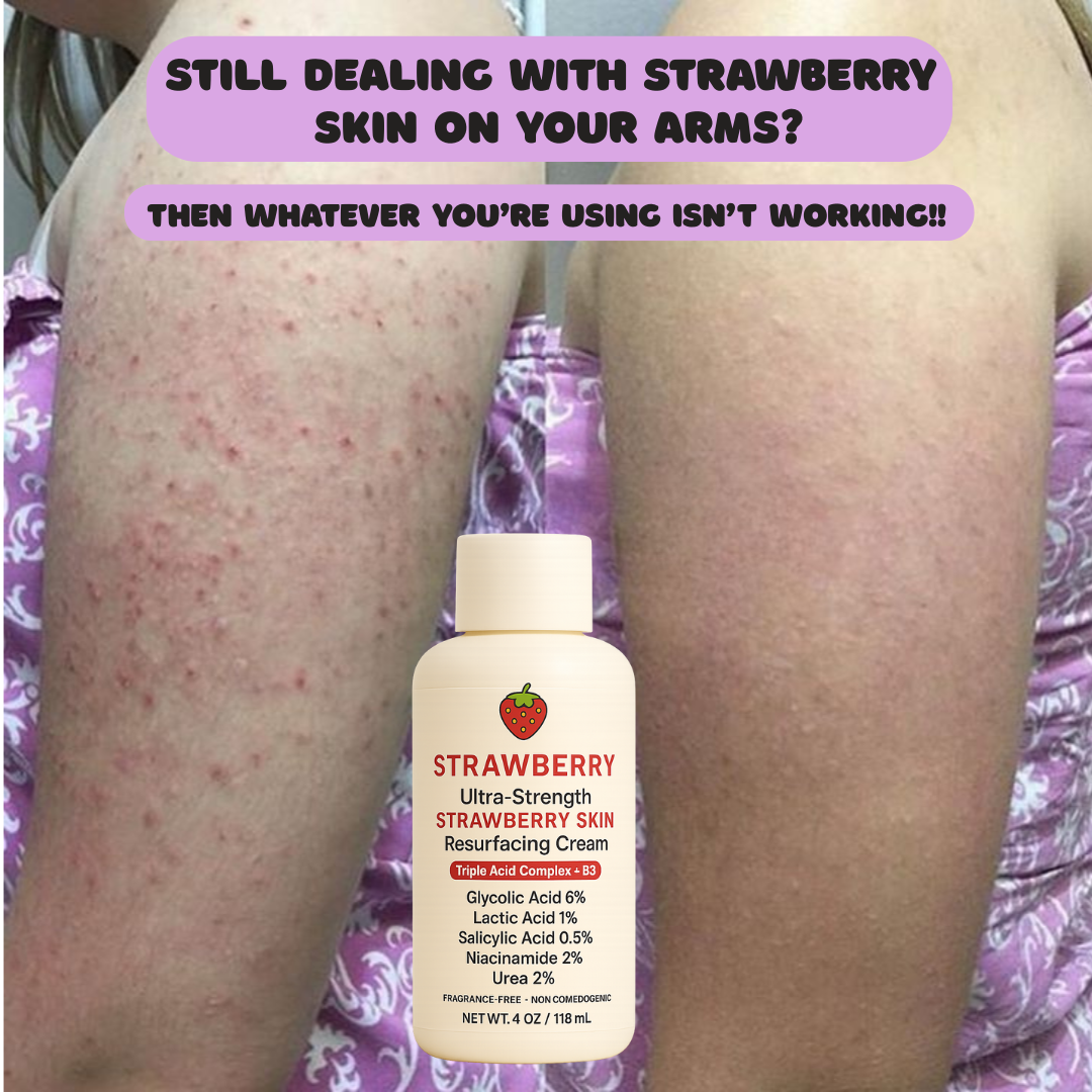 Try Strawberry Facebook ad