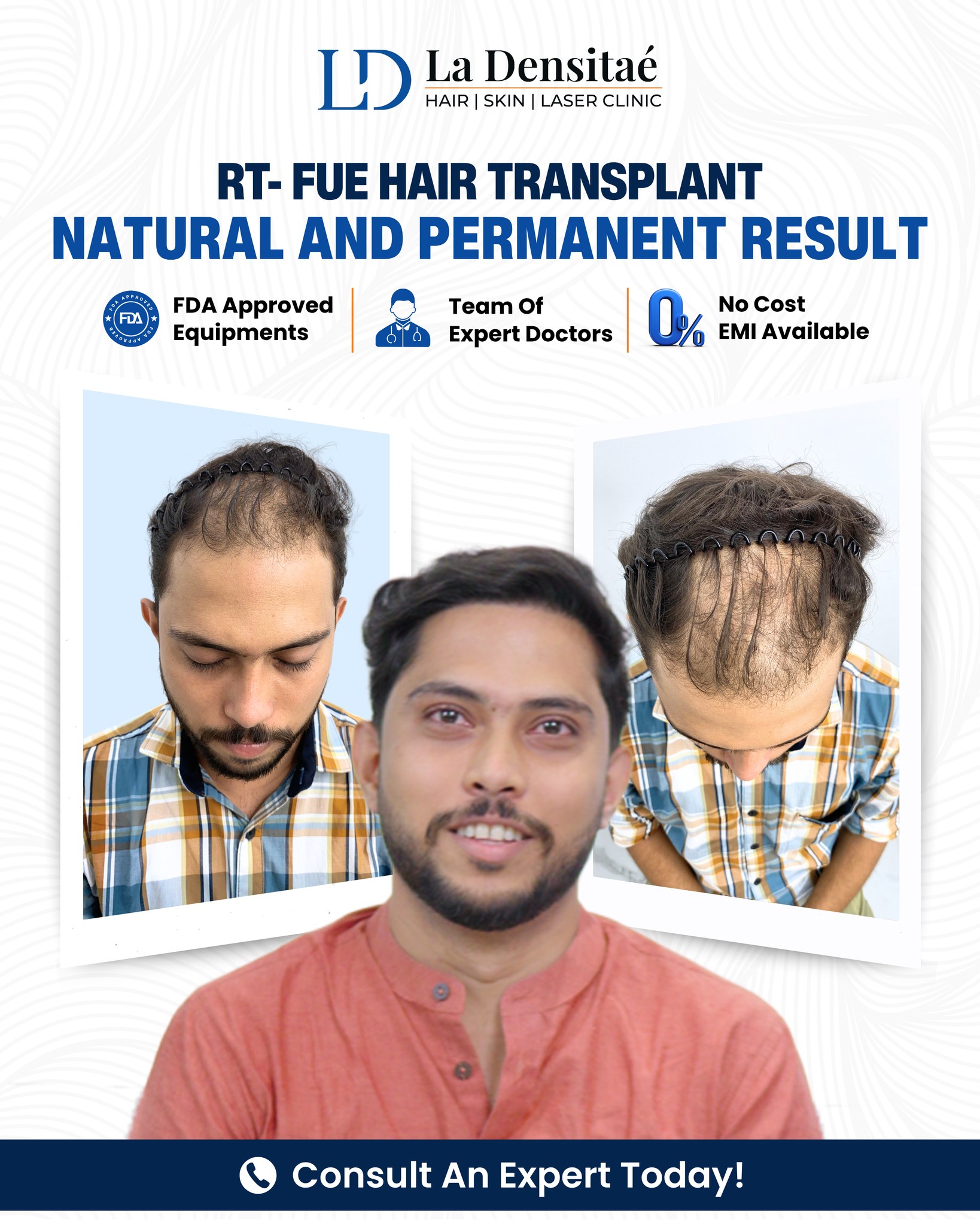 La Densitae Hair Transplant Clinic Facebook ad