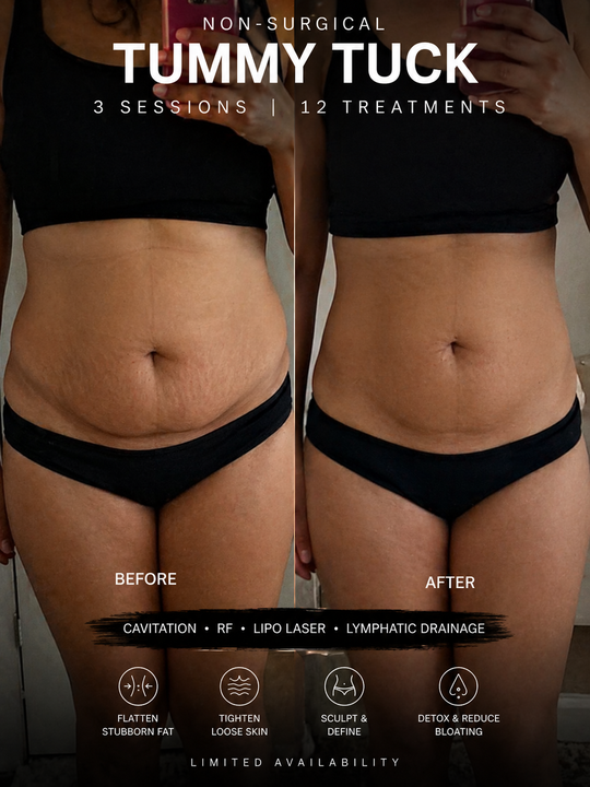 Lizzie Jaynes Beauty and Wellness Clinic Facebook ad: 50% OFF Body Sculpting