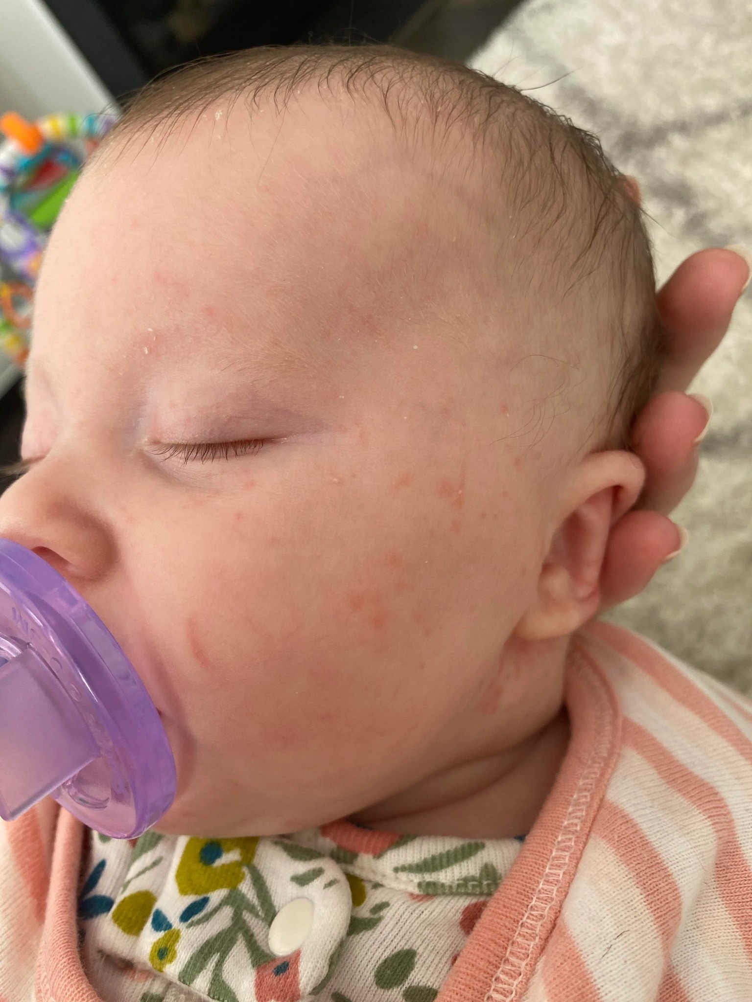 Jessica Rossi Facebook ad: Read this if your baby has eczema