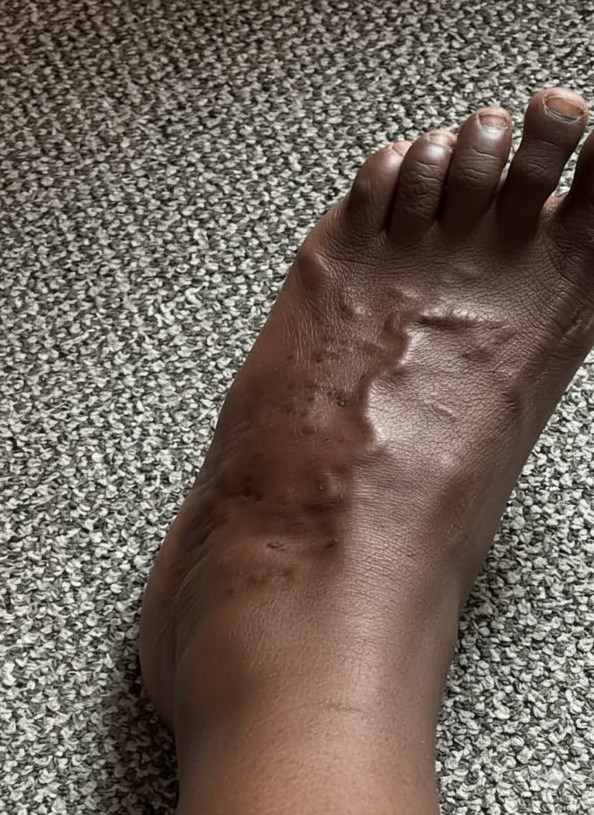 Dr. Marcus Thompson - Black Health Facebook ad