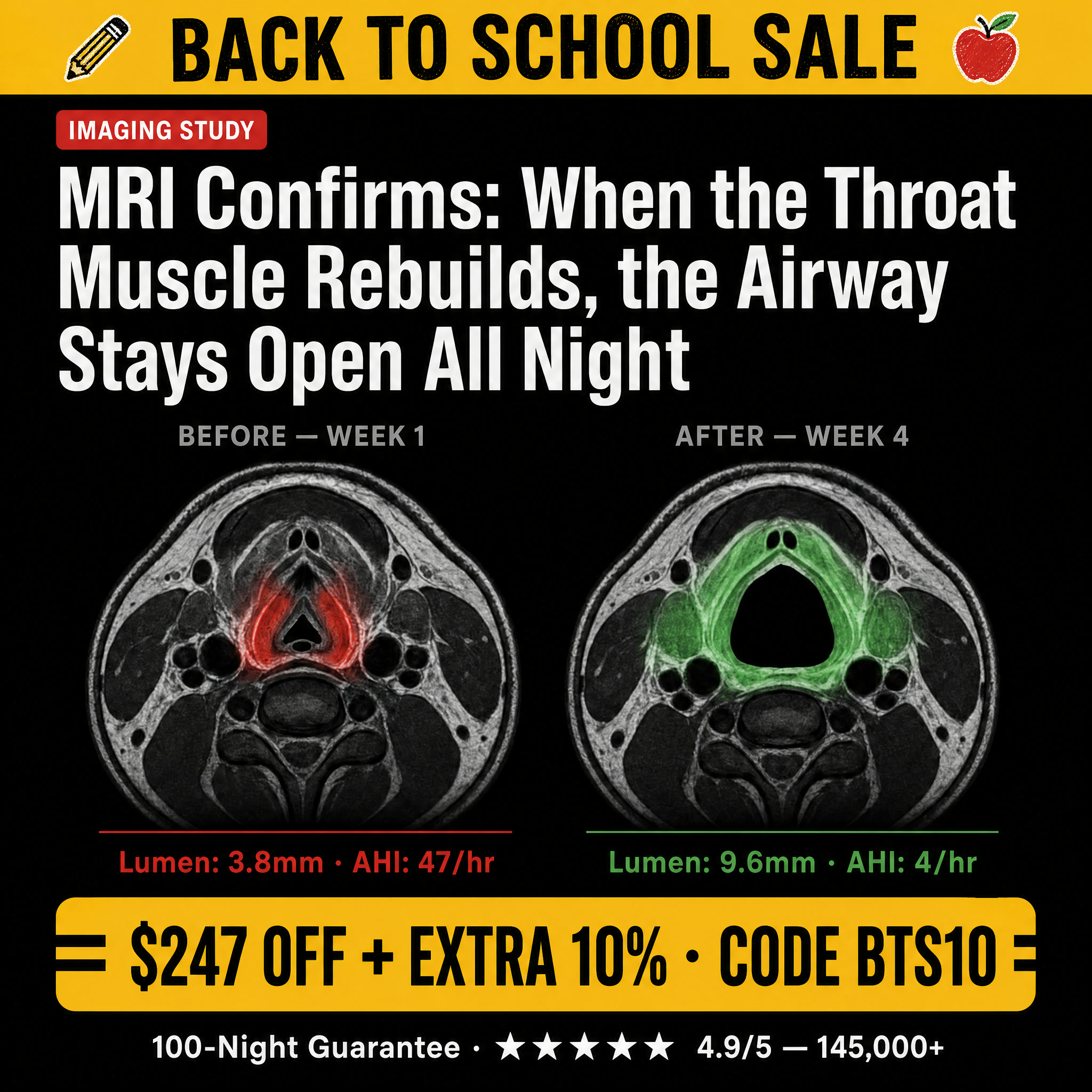 SleepEase Facebook ad: Back To School Sale: $247 OFF + Extra 10%