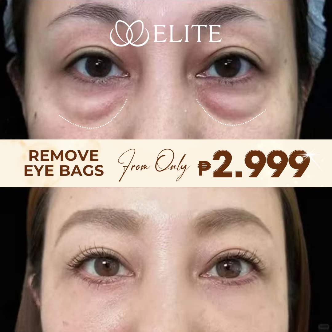 ELITE-Korean Beauty Technology Facebook ad: REMOVE EYE BAGS FROM ONLY 2999
