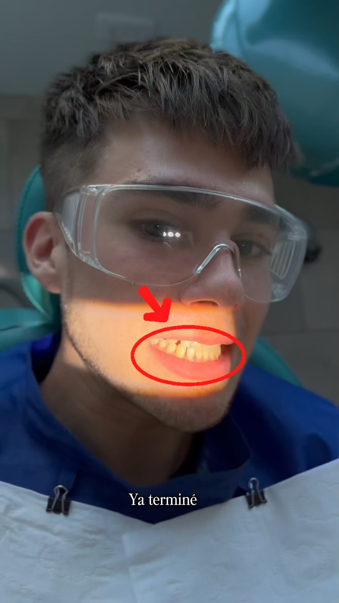 Wizz Chile Facebook ad: Corrige tu sonrisa con alineadores invisibles guiados por…