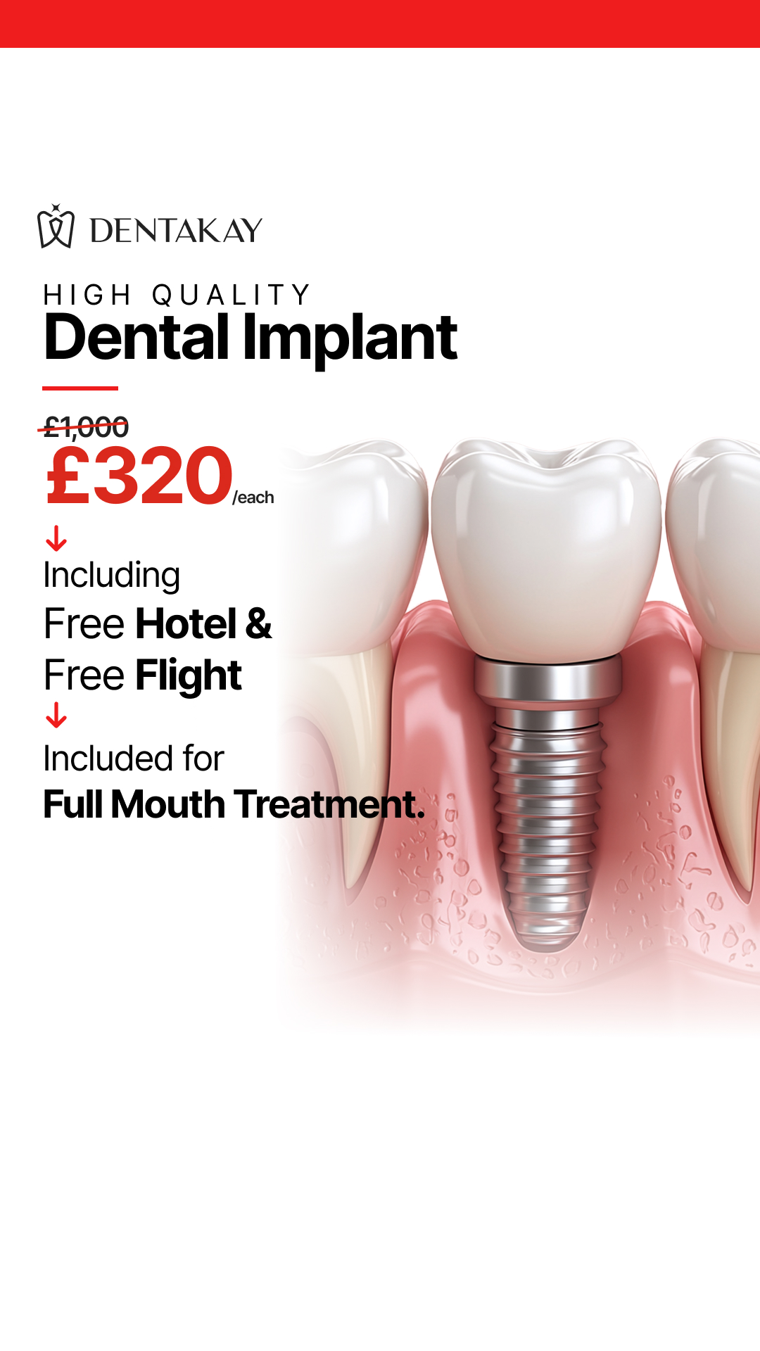 Dentakay Dental Clinic Facebook ad