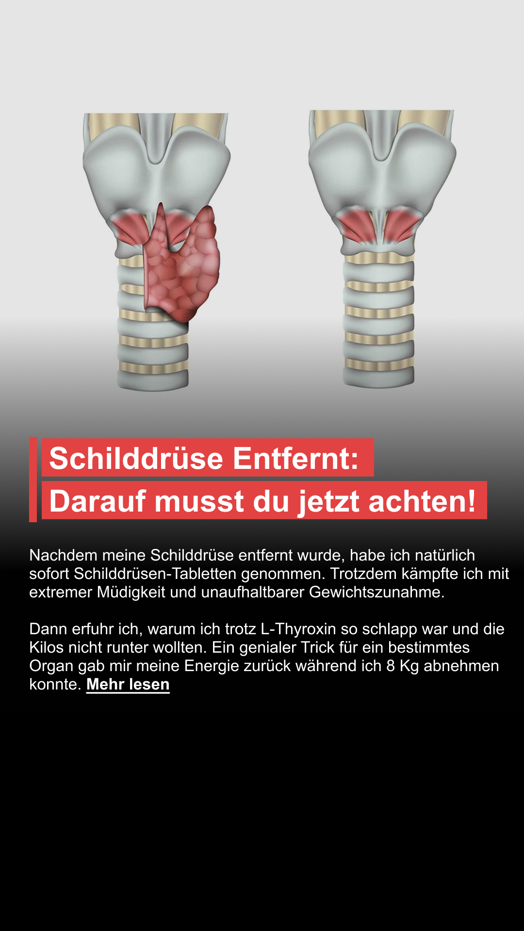 Mission Schilddrüse Facebook ad