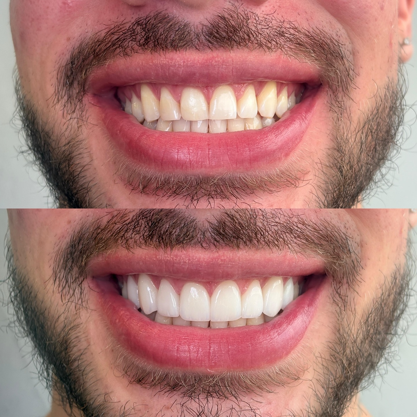 Dr. Smile Colombia Facebook ad