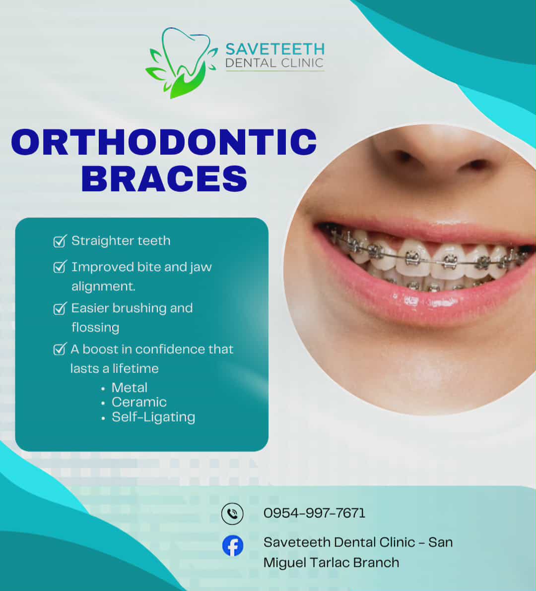 Saveteeth Dental Clinic-San Miguel Tarlac Branch Facebook ad: For your dental needs, come see us at…