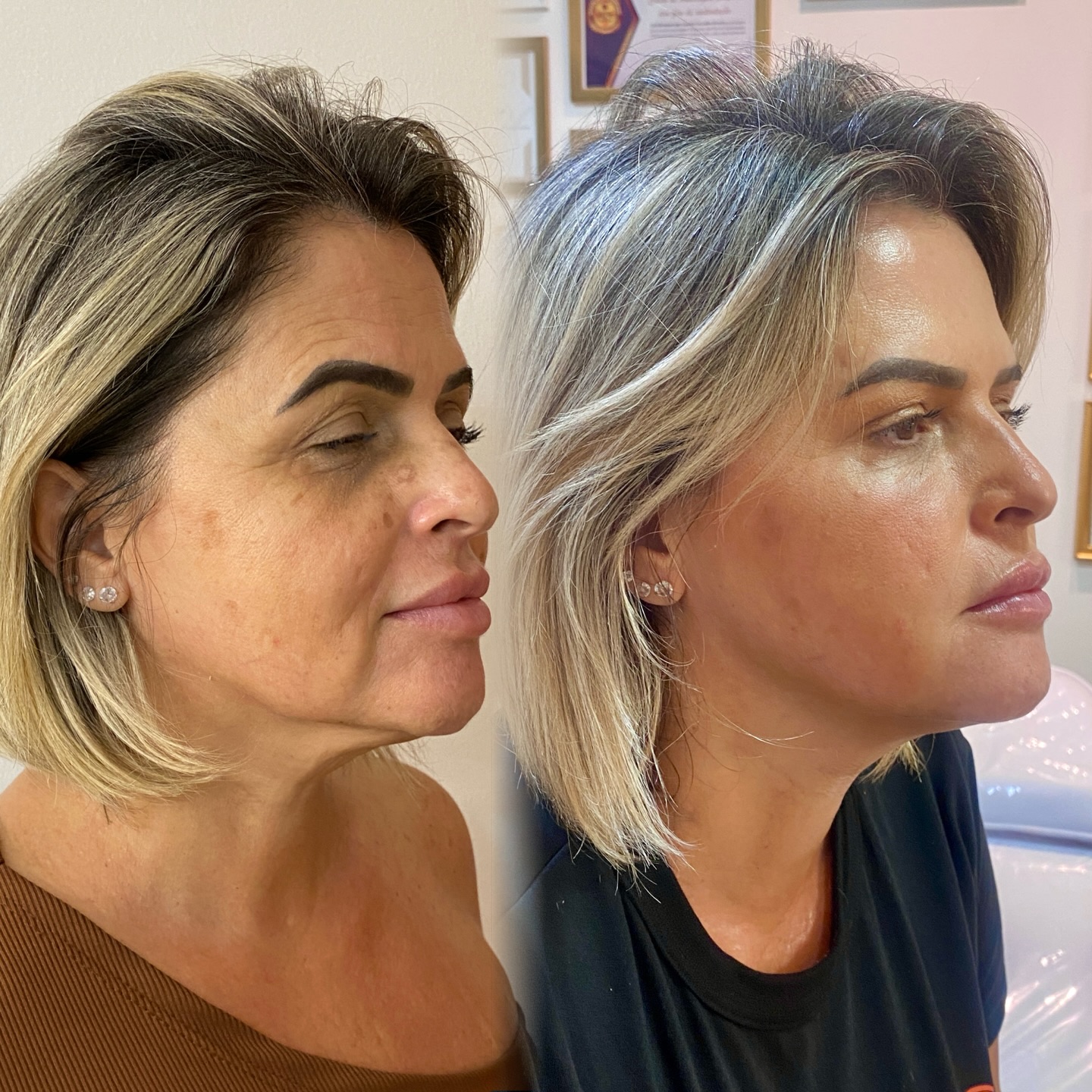 Dra. Laís Carvalho Facebook ad: Rejuvenescimento que vai além da estética
