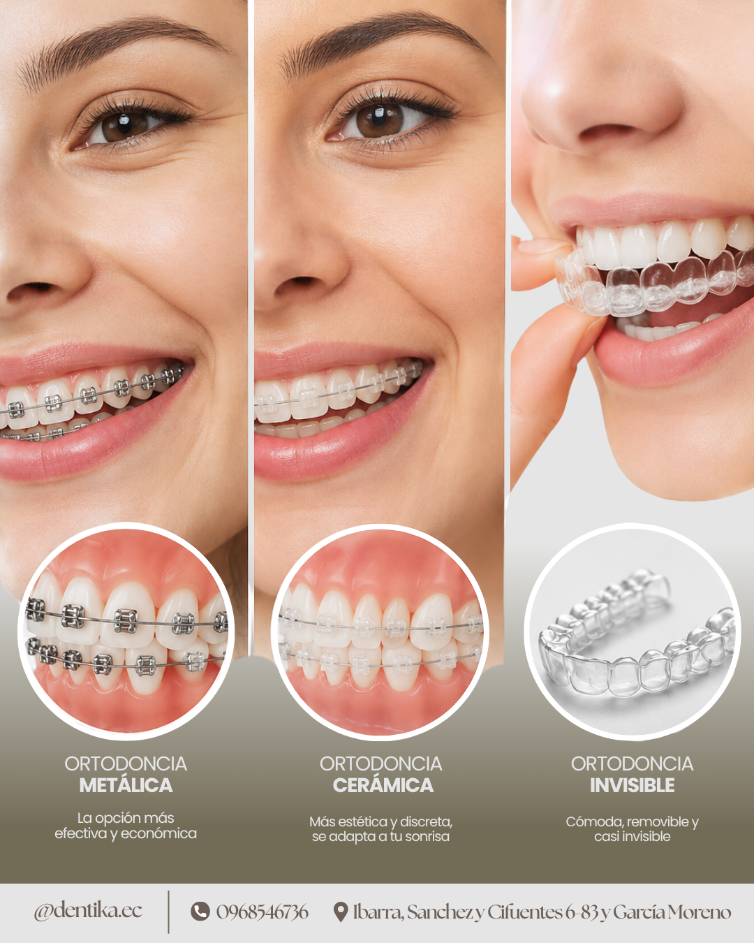 Déntika Odontologia Facebook ad: Dientes desalineados? Tenemos la solución