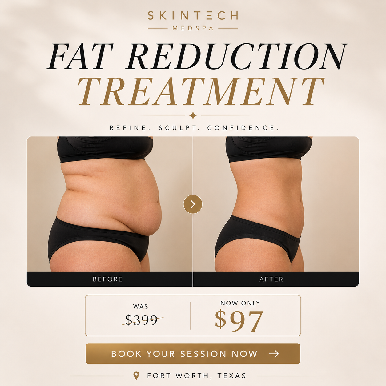 SkinTech Spa Facebook ad: $97 Body Contouring (Reg. $399)