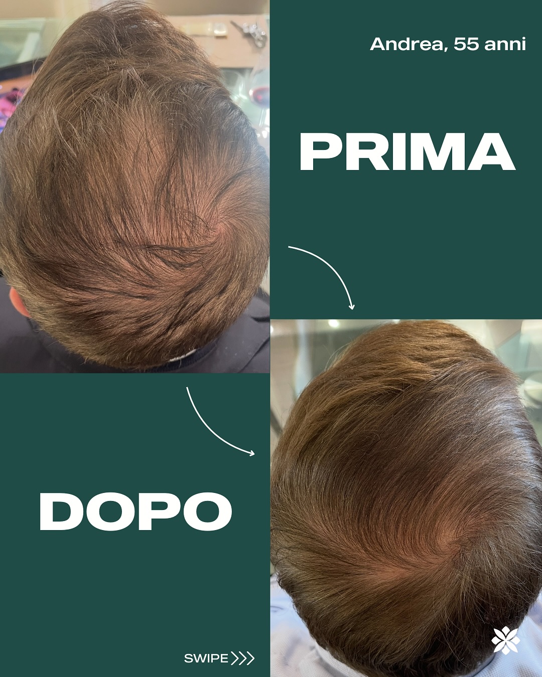 Ballangi Facebook ad: Ottieni capelli Forti e Sani