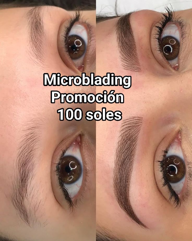Anthuanett Flores De La Cruz Facebook ad