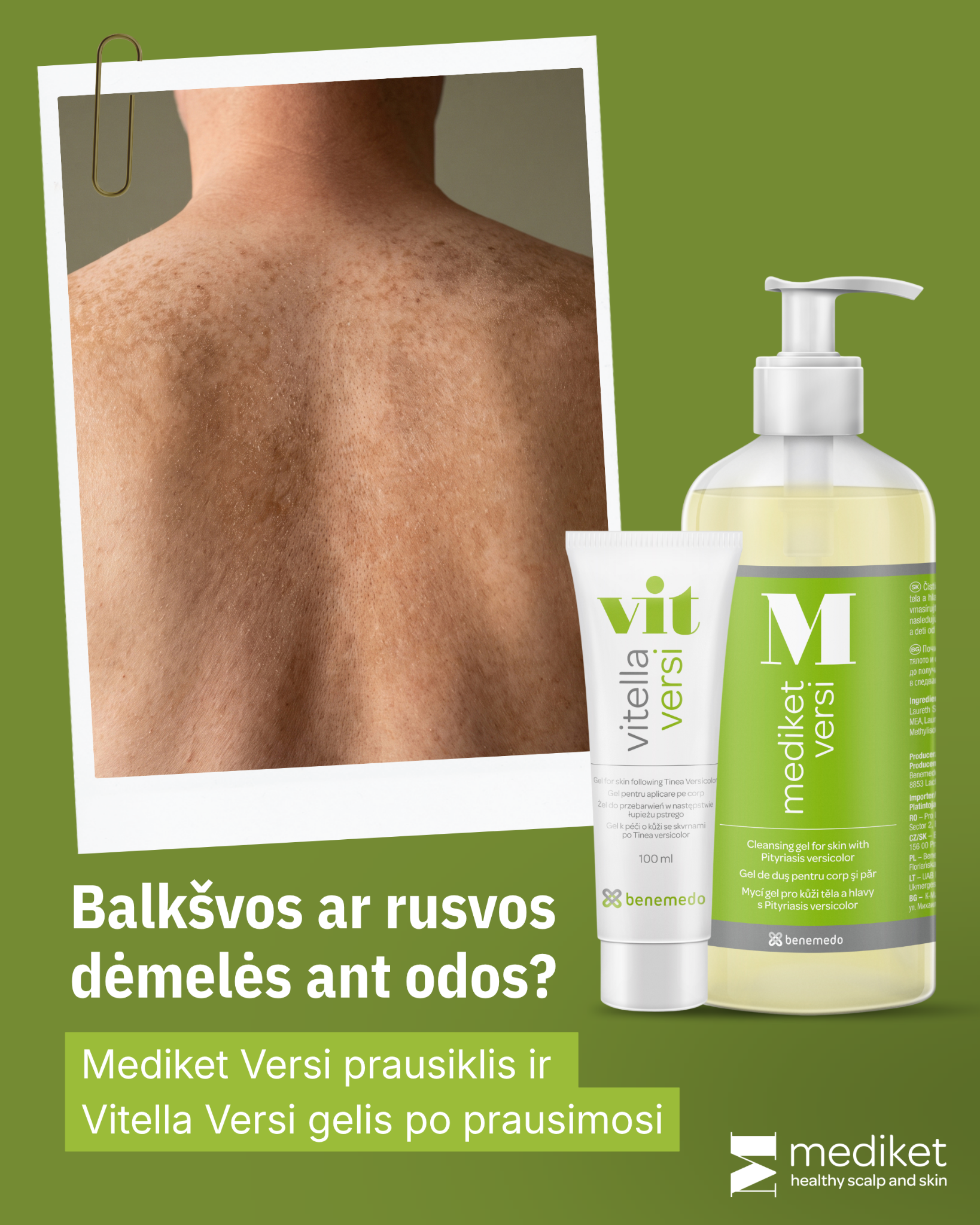Vitella & Mediket Lietuva Facebook ad: Pasirūpinkite savo oda