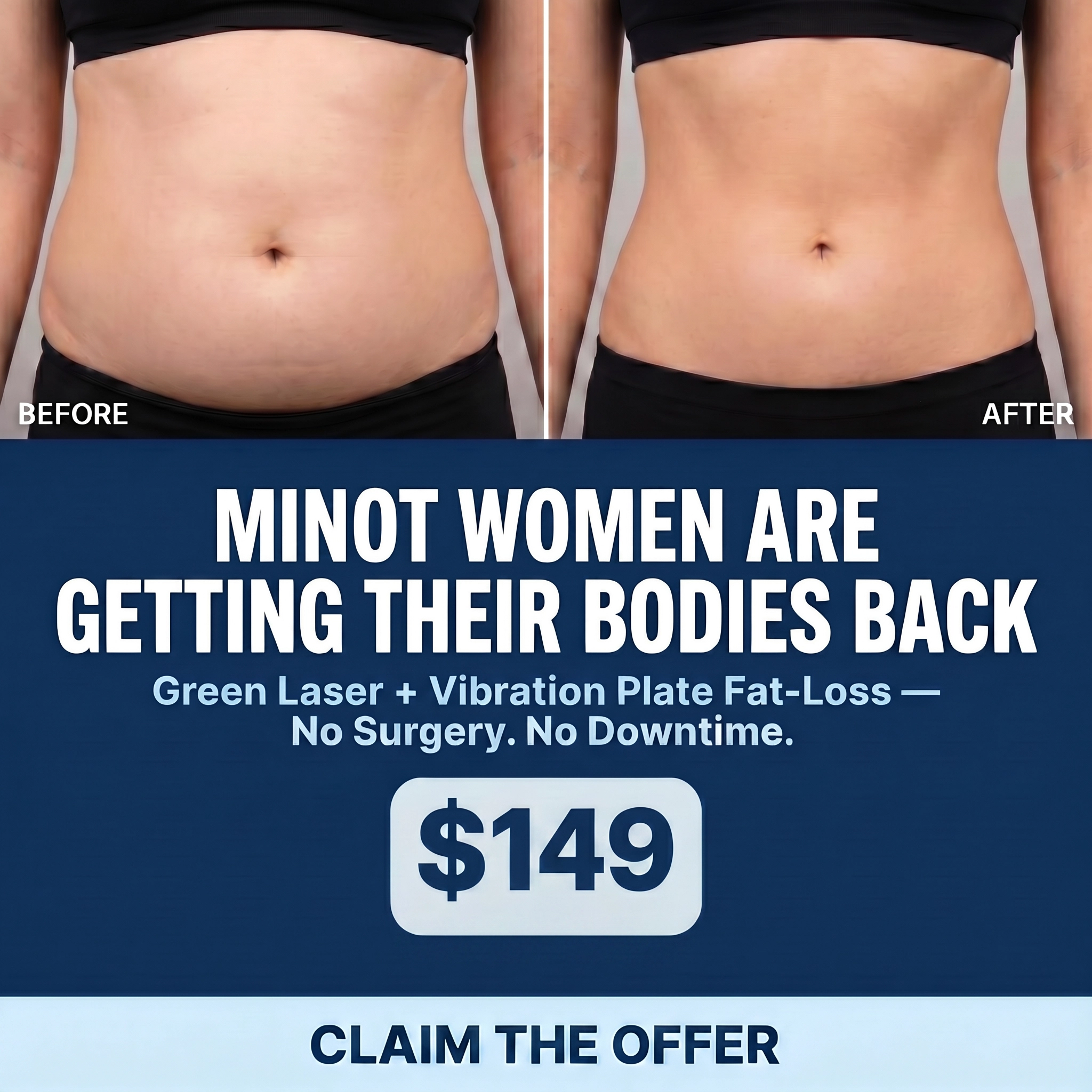 LOR Spa Facebook ad: Tummy Fat Meltdown Package, Just $149