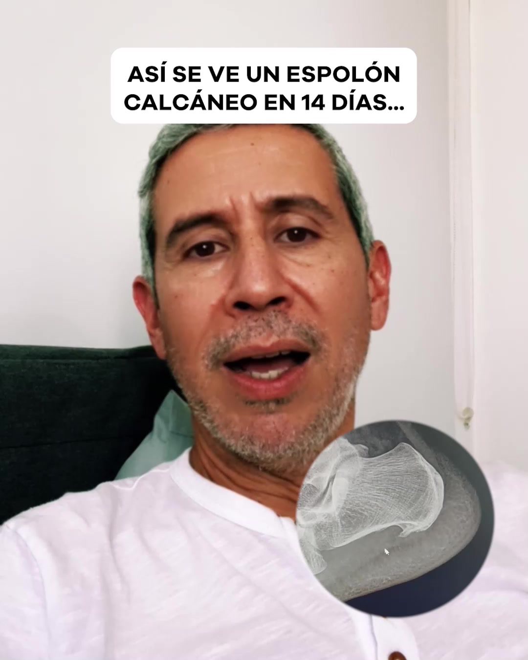 SereniVida Co Facebook ad: ¡Dile adiós al dolor del espolón calcáneo y…